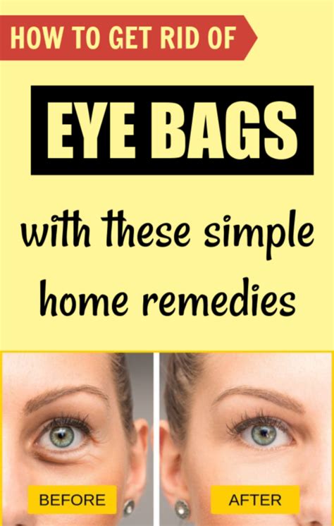 3 Best Home Remedies To Treat Under Eye Bags At Home Under Eye Bags