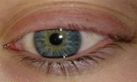 Aber dann wachsen die haare so richtig dicht und stark wieder nach. wachsen Wimpern komplett nach und was tun damit es nicht ...