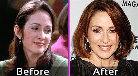 Patricia heaton isn't afraid to admit she's had some . Patricia Heaton Plastic Surgery Photos | Plastic surgery ...