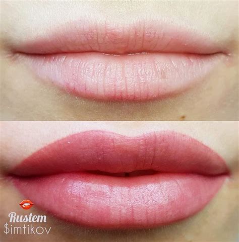 Correction Of The Lips Shape Create Full Lips In 2020 Permanent