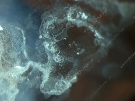 Chemical Burn Stock Image C0272071 Science Photo Library