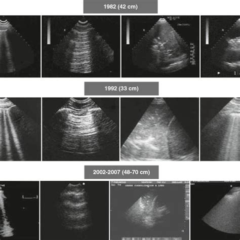 Pdf Whole Body Ultrasonography In The Critically Ill