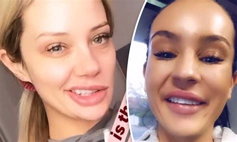 Jessika Power And Ines Basic Look Unrecognisable After Numbing Injections Daily Mail Online