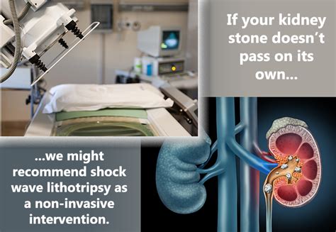 Kidney Stones Center For Urologic Care Of Berks County