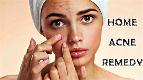 Acne Treatment At Home How To Remove Acne Youtube