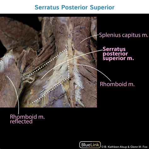 Gross Anatomy Glossary Serratus Posterior Superior Photos Draw It To Know It