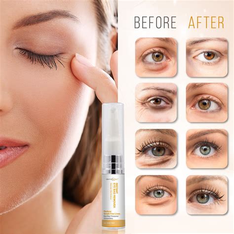 Instant Eyebag Remover Anti Aging Reduce Dark Circles Puffiness Under Eye Bags Wrinkles