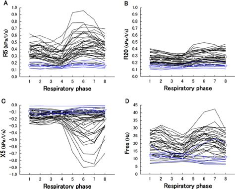 Within Breath Impulse Oscillometry Selected Parameters R5 A R20