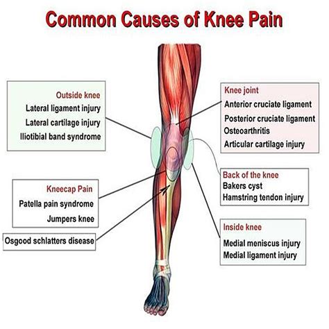 Common Causes Of Knee Pain And How To Treat Them