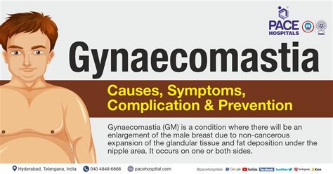 Gynecomastia Symptoms Causes Complications And Prevention