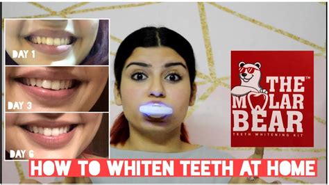 Testing Teeth Whitening Kit Ft Molar Bear Youtube