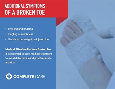 Design Sprained Toe Vs Broken Toe