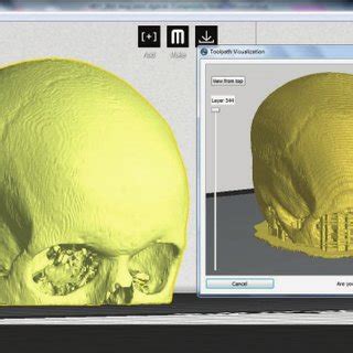 Invesalius is a free medical software used to generate virtual reconstructions of structures in the human body. Skull stripping in InVesalius medical image program ...