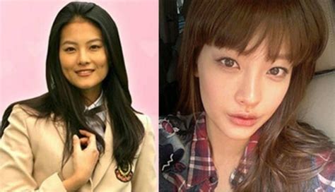 Seo Ye Ji Surgery 💖im Ji Hye Plastic Surgery Before And After Photos