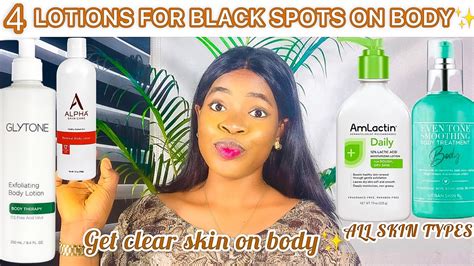 4 Best Body Lotion For Dark Spots On Body How To Get Clear Skin
