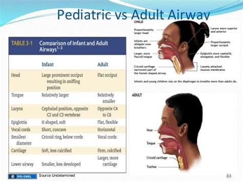 Infant Airway Compared To Adult