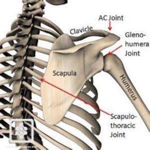 Snapping Scapula Expert Advice You Need To Know