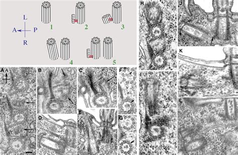 Centrin Deficiency In Paramecium Affects The Geometry Of Basal Body