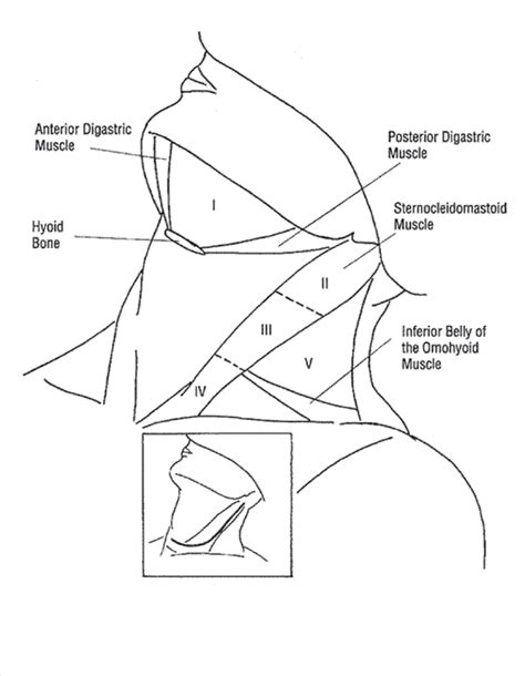 A Logical And Stepwise Operative Approach To Radical Neck Dissection