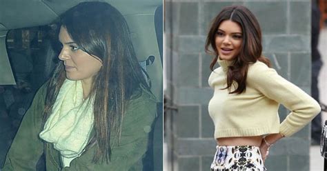 Has Harry Styles Girlfriend Had Surgery Kendall Jenner Spotted With