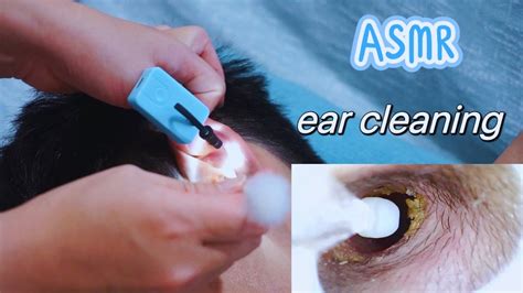 Asmr Real Person Ear Cleaning And Ear Massage No Talking Youtube