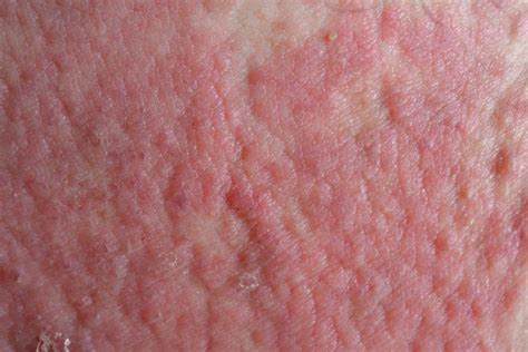 Red Spots On The Skin