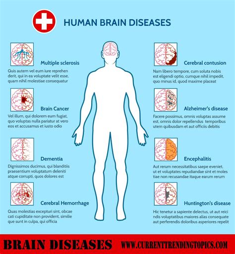 Brain Diseases Common Causes Symptoms And Treatments In Brain Diseases Human Digestive