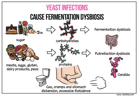 Yeast Infection Dangerous Invasive Candidiasis Candidiasis Types