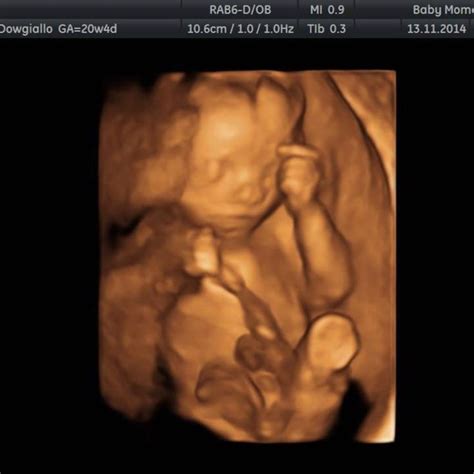 Pin On Amazing 4d Baby Scan Berkshire Call