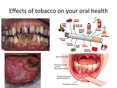 what are the diseases and side effects that tobacco can cause