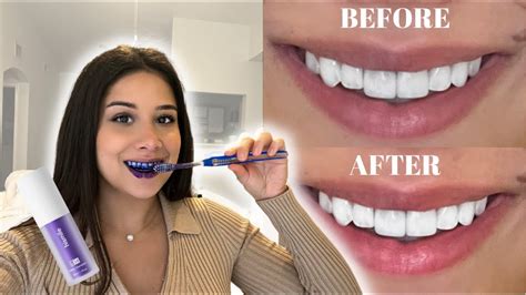 i tried the tiktok famous purple toothpaste to whiten my teeth hismile v34 purple teeth