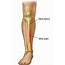 Leg Pain Treatment Guide  Lower