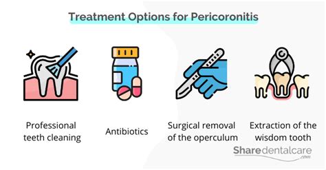 Pericoronitis Home Remedy Share Dental Care