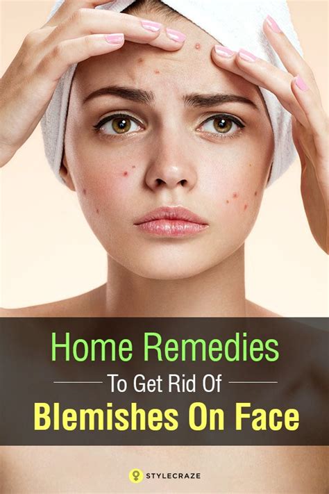 19 Best Home Remedies To Get Rid Of Blemishes On Face With Images