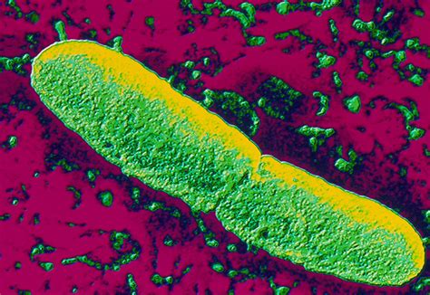 Yersinia Pestis Plague Bacteria Photograph By Pasieka Fine Art America