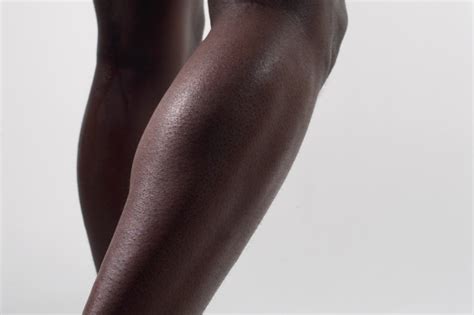 Dark Elbows And Knees What Causes Them And How To Fix It