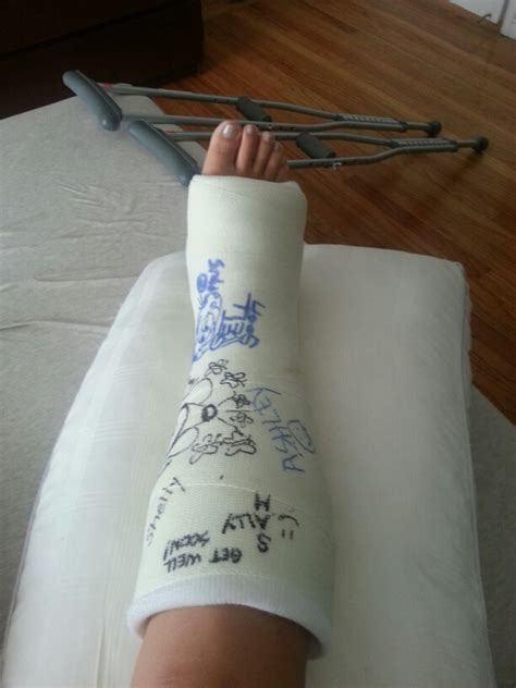 My Broken Ankle Art On My Cast