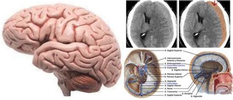 Villa, de 37 años, era estudiante universitario de ciencias del deporte y participó de manera activa en. Parénquima Cerebral: ¿Que Es? Lesiones Asociadas ...