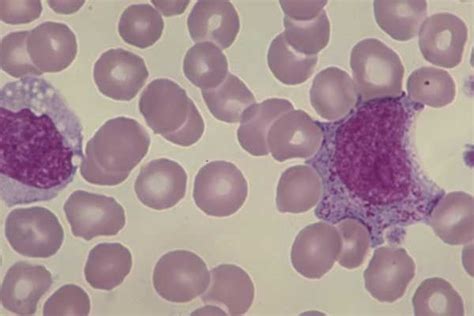 Monocyte Neutrophilic Myelocyte Normal Marrow Hematology Medical