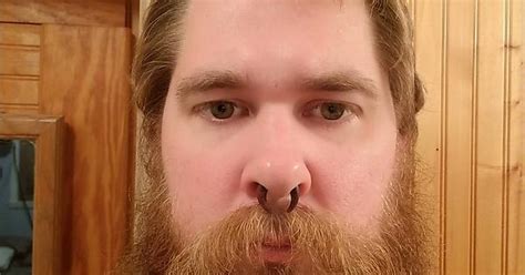 Post Chemo Beard Managed To Grow This In About 4 Months Running On Low Testosterone Imgur