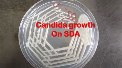 Candida Albicans Colony Characteristics On Sabouraud Dextrose Agar Sda