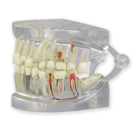 Clear Human Jaw With Teeth Model 1019540 2861 Anatomical Tooth