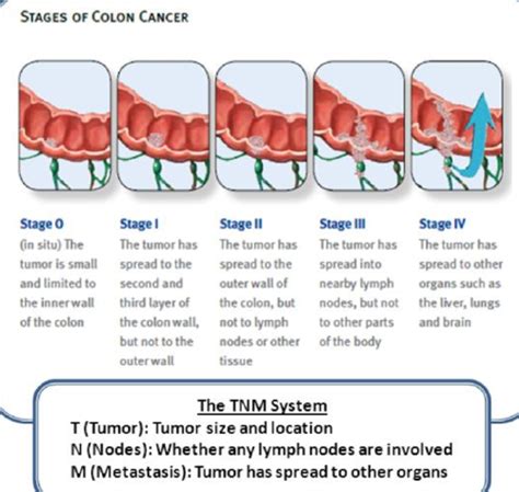 Skin Tumors Flashcards Quizlet