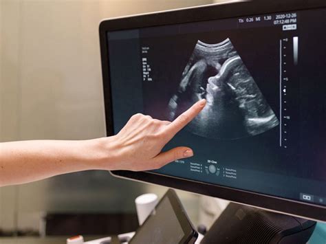 5 D Ultrasounds What They Are And If You Should Get One