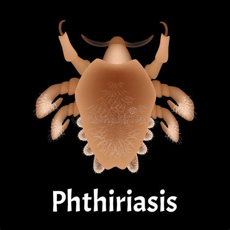 Parasitic Diseases Of Phthiriasis Pediculosis Pubis Pubic Lice Structure Sexually Transmitted