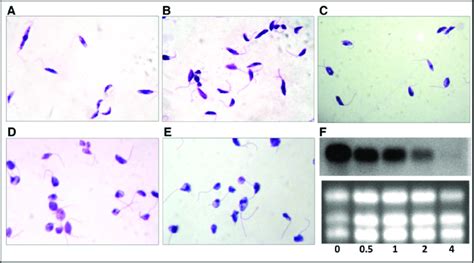 Leishmania Braziliensis Morphology And Tubulin Rna Accumulation After Download Scientific