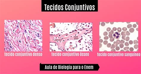 Tecido Conjuntivo e suas características Biologia Enem