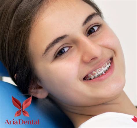 Cosmetic Dentist Mission Viejo Talk About Lingual Braces