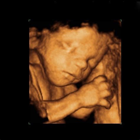 3d Baby Scan 4d Baby Scan 3d Ultrasound And 4d Ultrasound