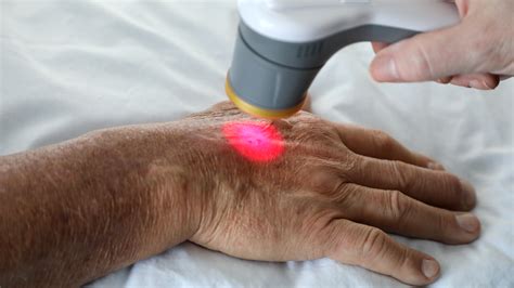 What Is Pbmtlllt Laser Pain Therapy